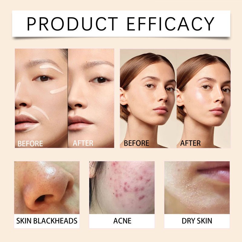 🎁2025 Varmt salg💖Fuktighetsgivende CC-krem